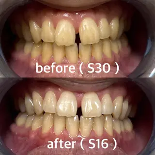 メンズ 九州オーラルホワイトニング所属・田中 毬亜/薬院警固店のエステ・リラクイメージ