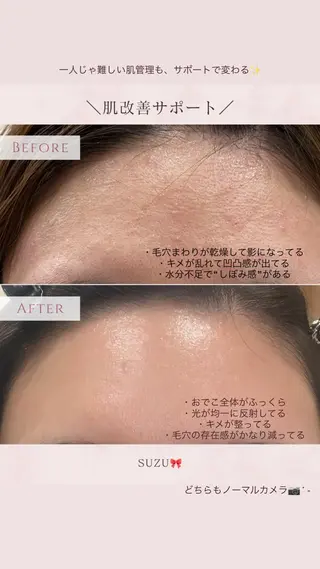 肌改善サポート suzu🎀の眉毛・アイブロウイメージ