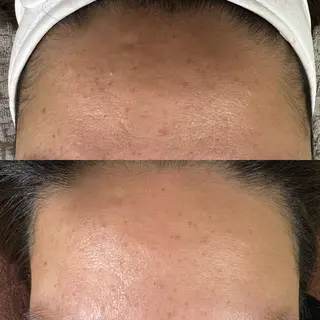 ran cocochiのマツエク・マツパデザイン