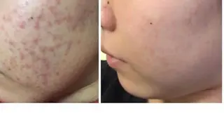 朝重い人専用 肩甲骨調整のエステ・リラクイメージ