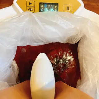 耳ツボ/体質改善/ 温活La mer月島のその他イメージ