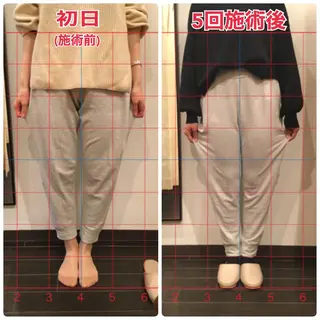 ロング 整体×美容鍼 ジェイペックのエステ・リラクイメージ