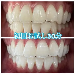 ホワイトニング🦷 ネイル💅LEAのその他イメージ