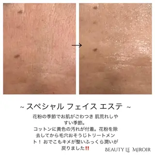 ビューティー ミロワールのエステ・リラクイメージ