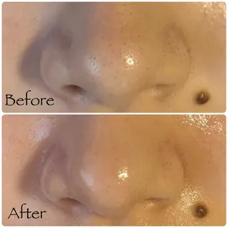 ソワン所属・脱毛 フェイシャル soin~ソワン~のエステ・リラクイメージ