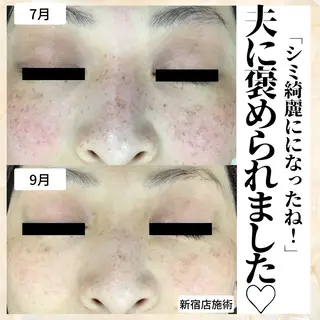 シミケア肌改善専門 トリニエンス新宿店のエステ・リラクイメージ