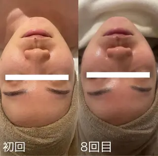 中目黒ハーブピーリン グ🌿ララピールのエステ・リラクイメージ