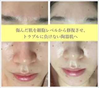CHERIE Hisadaのエステ・リラクイメージ