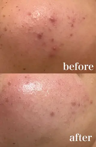 mignon /まつげパーマ・小顔のマツエク・マツパデザイン