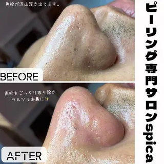 ピーリング専門サロン Spicaのエステ・リラクイメージ