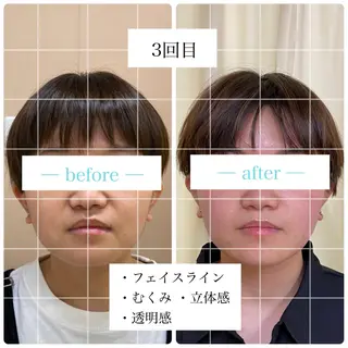 鍼灸サロン BBB3のその他イメージ
