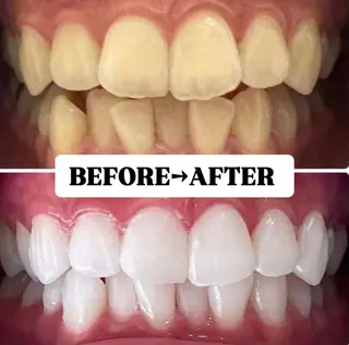 メンズ キッズ 歯科提携サロン ホワイトニング豊中のその他イメージ