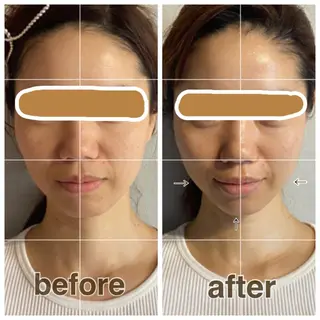 【小顔矯正】 salonaceのエステ・リラクイメージ