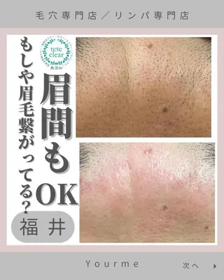 毛穴肌質ケアサロン Yourmeユアミーのエステ・リラクイメージ