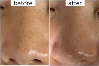 医療提携Beauty SalonMuseのエステ・リラクイメージ