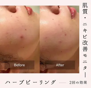 森 美優のエステ・リラクイメージ