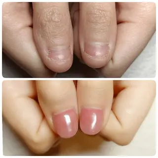 ネイル 深爪矯正/爪育成ケア manie nailのネイルデザイン