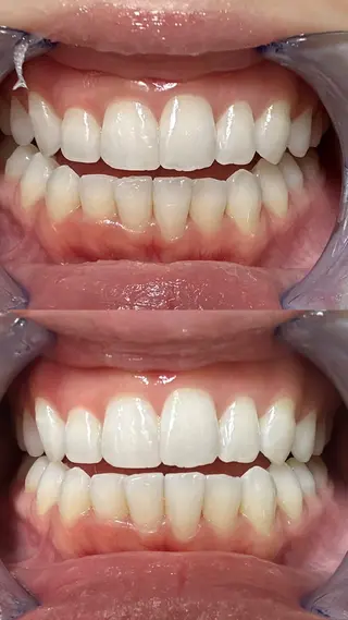 ホワイトニングサロン Bianのその他イメージ