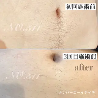 脱毛&フェイシャル NO.511のエステ・リラクイメージ