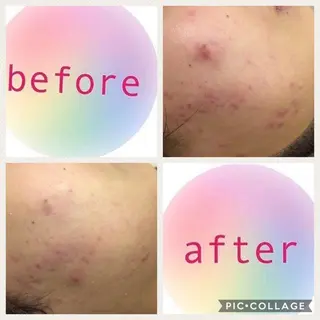 ミディアム カラー パーマ ヘアアレンジ メンズ キッズ ネイル マツエク・マツパ ニキビ・肌質改善専門 ♡人生が変わるサロンのエステ・リラクイメージ