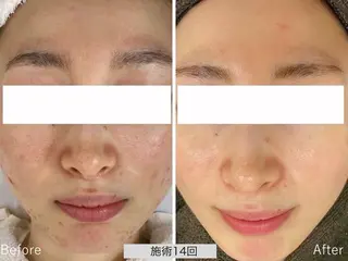 UILANI所属・UI LANIのエステ・リラクイメージ