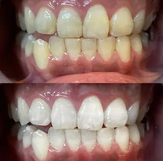 LBSホワイトニング 🌐 上野店公式のエステ・リラクイメージ