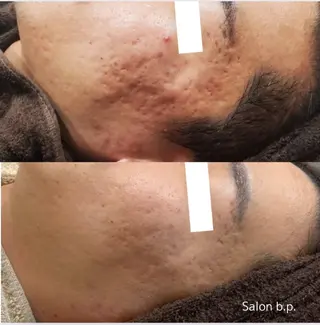 Salon b.p. 渋谷のエステ・リラクイメージ
