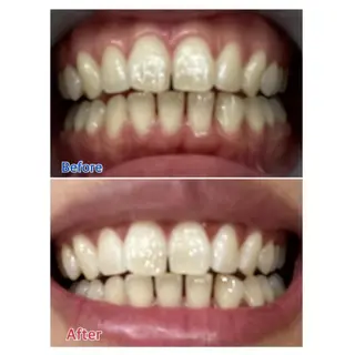 Ｍ渋谷 ホワイトニングのエステ・リラクイメージ