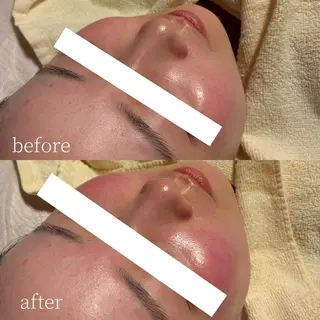 Erika komorebi_のエステ・リラクイメージ