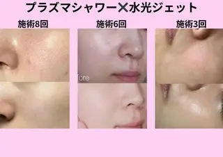 ネイル aliaハーブ水光店 エステティシャン募集のエステ・リラクイメージ