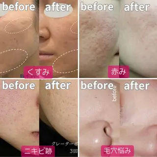 マツエク・マツパ 愛維美水光美肌専門店 メンズレディースokのエステ・リラクイメージ
