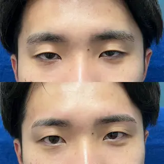 アイブロウ 男眉salon On Fleek!銀座店所属・鈴木 真奈の眉毛・アイブロウイメージ