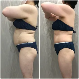 エステティックサロン ベルネのエステ・リラクイメージ