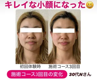 小顔サロン (ラ リュミエール)のエステ・リラクイメージ