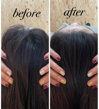 個室ドライヘッドスパ 🍃moriのエステ・リラクイメージ