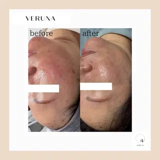 ピーリング専門店 Belluteのエステ・リラクイメージ