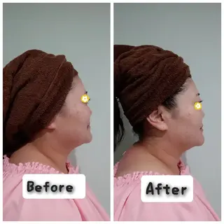 エステティクサロン Moon-bellのエステ・リラクイメージ