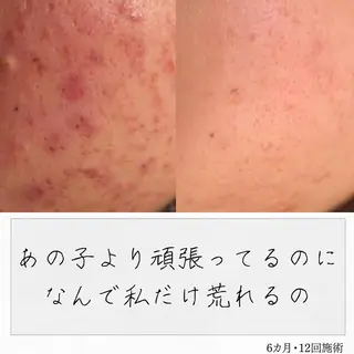 ニキビ経験者が施術 する専門サロン🌻のエステ・リラクイメージ