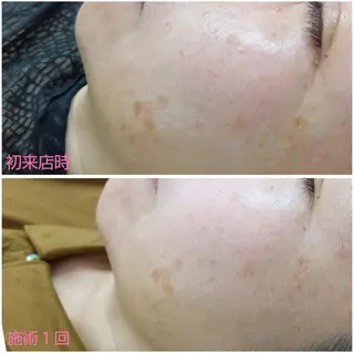 シミケア専門店 HAQUAのエステ・リラクイメージ