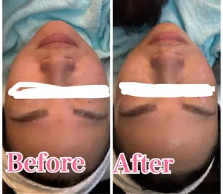 ビューティーサロン　プリズム所属・久留本 茜のエステ・リラクイメージ