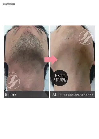 メンズ Kanaloa beauty salon所属・腸もみ・メンズ脱毛・ 毛穴洗浄〜カナロア〜のエステ・リラクイメージ