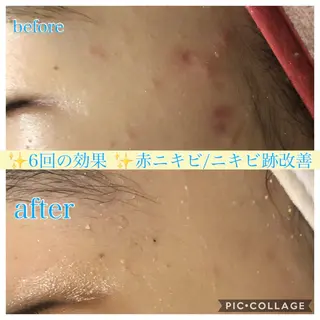ロング カラー パーマ ヘアアレンジ メンズ キッズ ネイル マツエク・マツパ EnsorClair 代表　野口真央のエステ・リラクイメージ