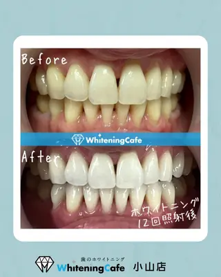 ホワイトニングカフェ 小山店のエステ・リラクイメージ