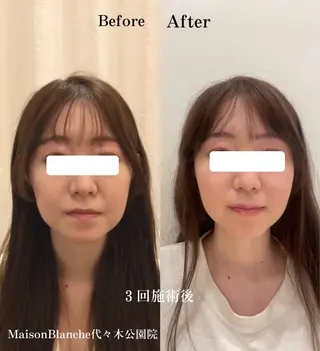 🌸美容鍼サロン🌸 メゾンブランシェ🌈のエステ・リラクイメージ