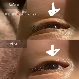 毛穴から始める肌メン テマンダリンオレンジのエステ・リラクイメージ