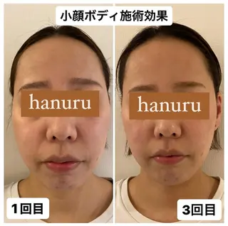 美容整体・小顔矯正 hanuruのエステ・リラクイメージ