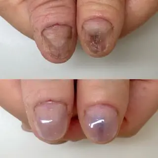 ネイル ネイルサロン アリュームのネイルデザイン