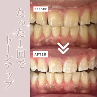 LIBRA自由が丘 ホワイトニングのその他イメージ