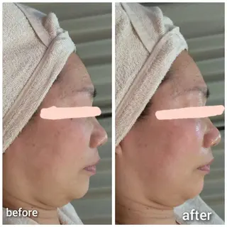 Beauty Salon AQUAのエステ・リラクイメージ