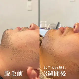 メンズ wax脱毛専門店 ハイラントのエステ・リラクイメージ